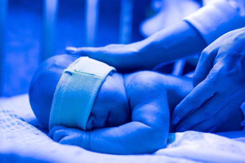 Novorodenecká žltačka sa po pôrode dá liečiť aj modrou fototerapiou