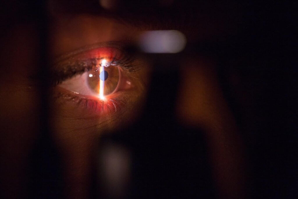 laserová operácia očí