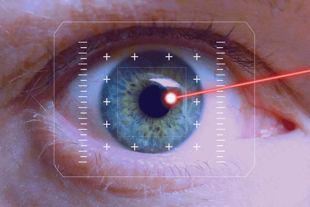 laserová operácia očí
